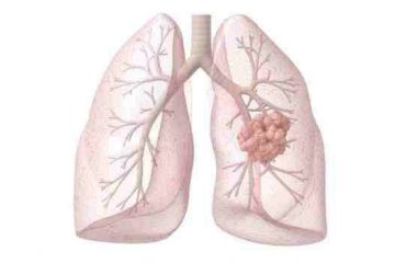 lungs