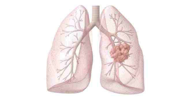 lungs